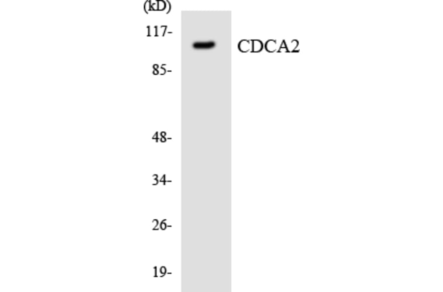Western Blot - Anti-CDCA2 Antibody (R12-2598) - Antibodies.com