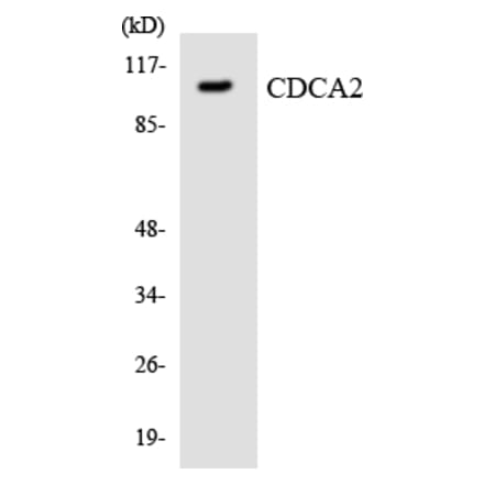 Western Blot - Anti-CDCA2 Antibody (R12-2598) - Antibodies.com