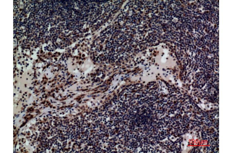 Immunohistochemistry - Anti-CD79B Antibody (C30384) - Antibodies.com