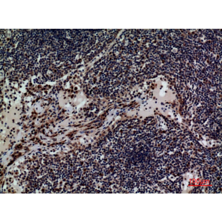 Immunohistochemistry - Anti-CD79B Antibody (C30384) - Antibodies.com