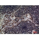 Immunohistochemistry - Anti-CD79B Antibody (C30384) - Antibodies.com