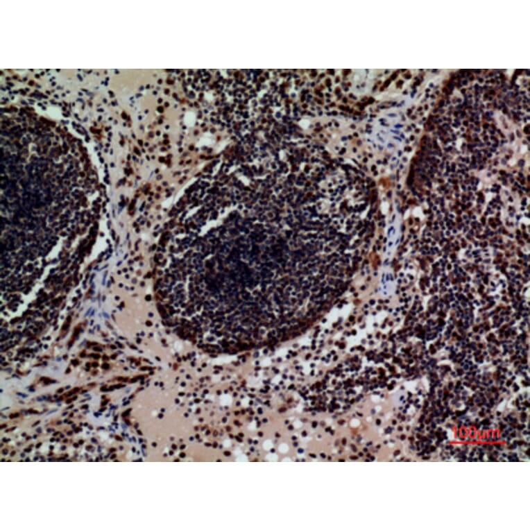Immunohistochemistry - Anti-CD79B Antibody (C30384) - Antibodies.com