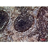 Immunohistochemistry - Anti-CD79B Antibody (C30384) - Antibodies.com