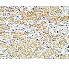 Immunohistochemistry - Anti-CD79A Antibody (C21274) - Antibodies.com