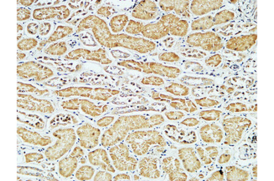 Immunohistochemistry - Anti-CD79A Antibody (C21274) - Antibodies.com