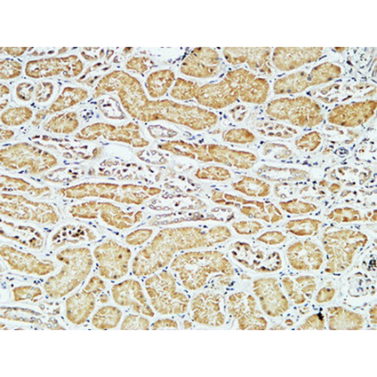 Immunohistochemistry - Anti-CD79A Antibody (C21274) - Antibodies.com