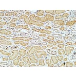 Immunohistochemistry - Anti-CD79A Antibody (C21274) - Antibodies.com