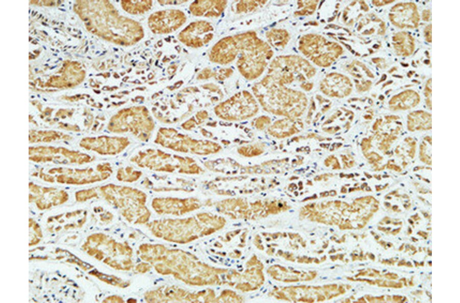 Immunohistochemistry - Anti-CD79A Antibody (C21274) - Antibodies.com