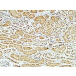 Immunohistochemistry - Anti-CD79A Antibody (C21274) - Antibodies.com