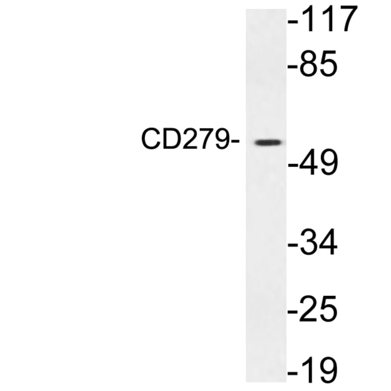 Western Blot - Anti-CD279 Antibody (R12-2072) - Antibodies.com