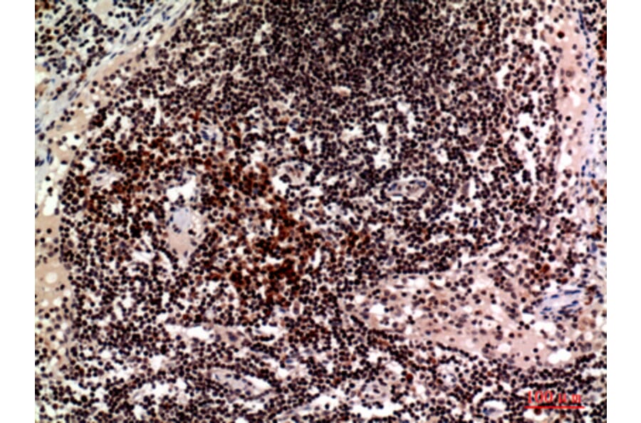 Immunohistochemistry - Anti-CD244 Antibody (C30457) - Antibodies.com