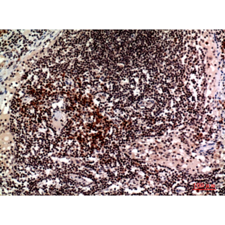Immunohistochemistry - Anti-CD244 Antibody (C30457) - Antibodies.com
