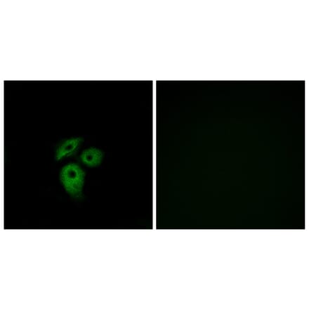 Immunofluorescence - Anti-CD234 Antibody (G081) - Antibodies.com