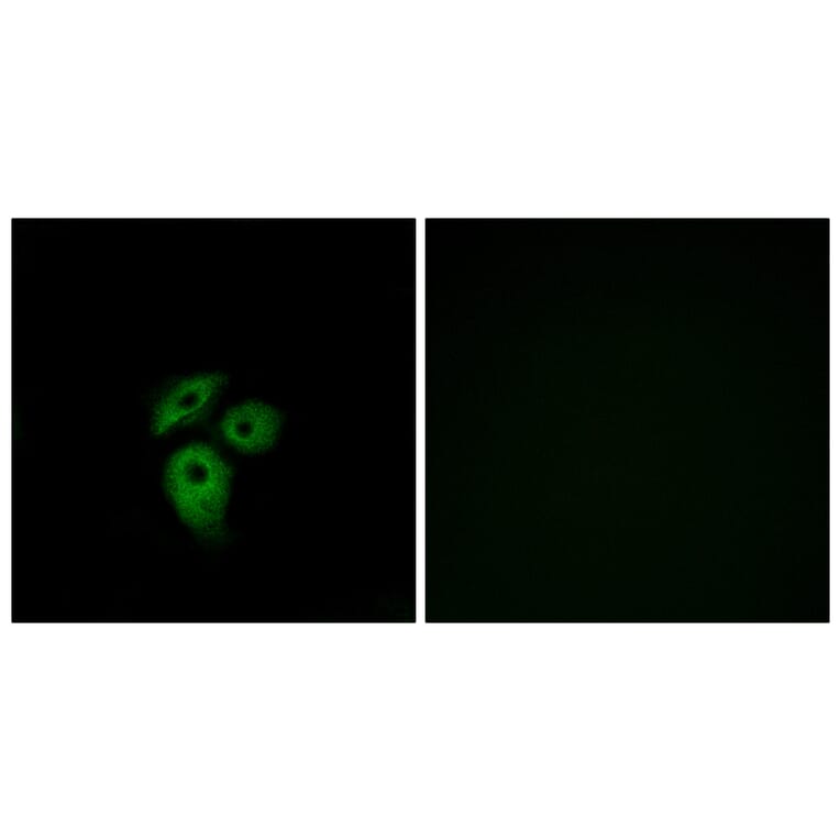 Immunofluorescence - Anti-CD234 Antibody (G081) - Antibodies.com