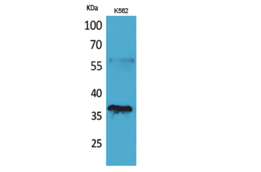 Western Blot - Anti-CD207 Antibody (C30493) - Antibodies.com