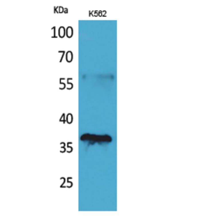 Western Blot - Anti-CD207 Antibody (C30493) - Antibodies.com