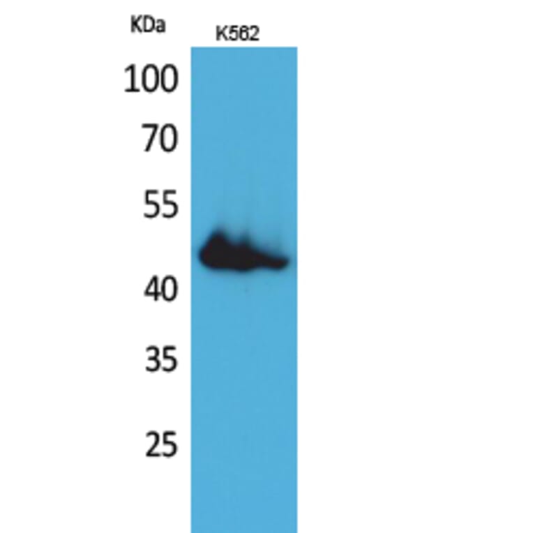 Western Blot - Anti-CD177 Antibody (C30544) - Antibodies.com