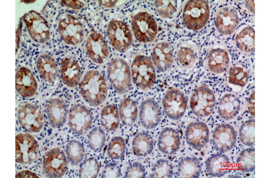 Immunohistochemistry - Anti-CD177 Antibody (C30544) - Antibodies.com