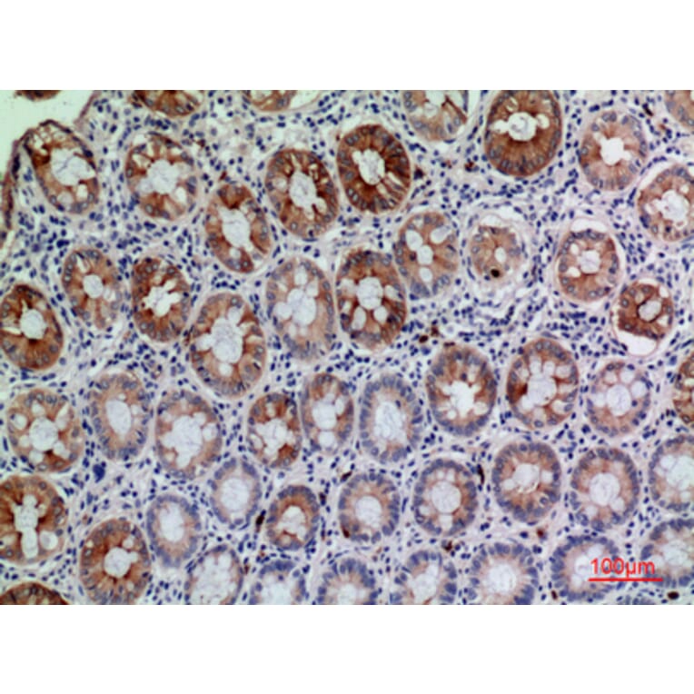 Immunohistochemistry - Anti-CD177 Antibody (C30544) - Antibodies.com