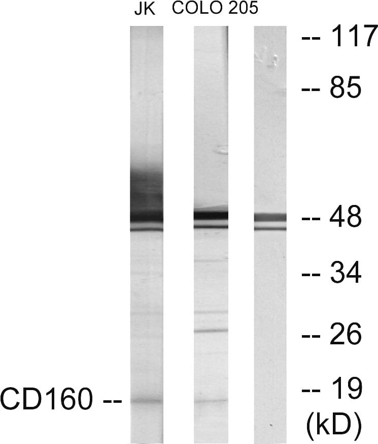 CD160枚以上 artirt A〜C CD160 Antibodies | Antibodies.com