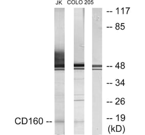 Western Blot - Anti-CD160 Antibody (C12076) - Antibodies.com