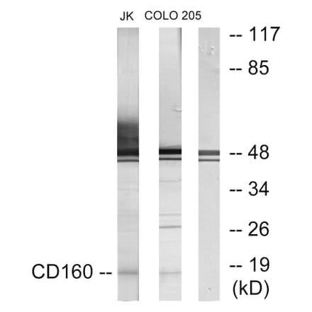 Western Blot - Anti-CD160 Antibody (C12076) - Antibodies.com