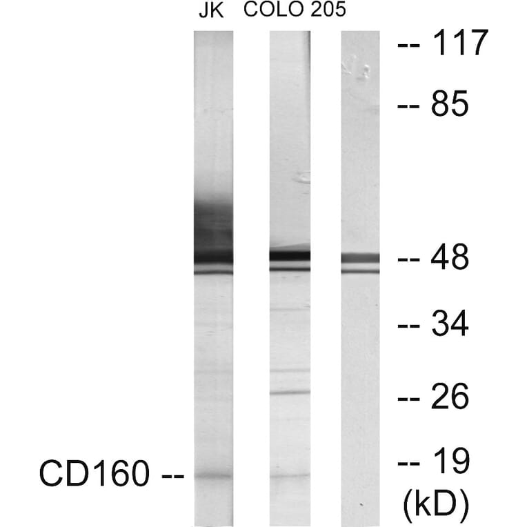 Western Blot - Anti-CD160 Antibody (C12076) - Antibodies.com