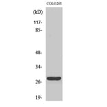 Western Blot - Anti-CD160 Antibody (C12076) - Antibodies.com