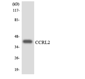 Western Blot - Anti-CCRL2 Antibody (R12-2581) - Antibodies.com