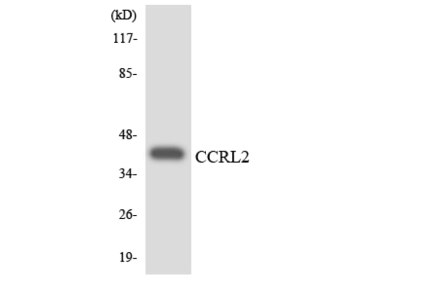Western Blot - Anti-CCRL2 Antibody (R12-2581) - Antibodies.com