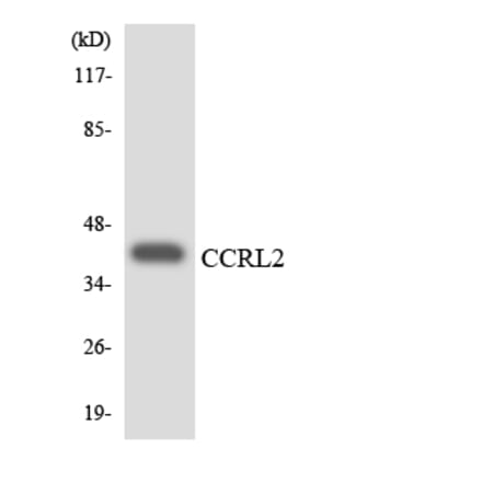 Western Blot - Anti-CCRL2 Antibody (R12-2581) - Antibodies.com