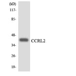 Western Blot - Anti-CCRL2 Antibody (R12-2581) - Antibodies.com