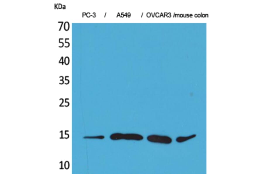 Western Blot - Anti-CCL26 Antibody (C30025) - Antibodies.com