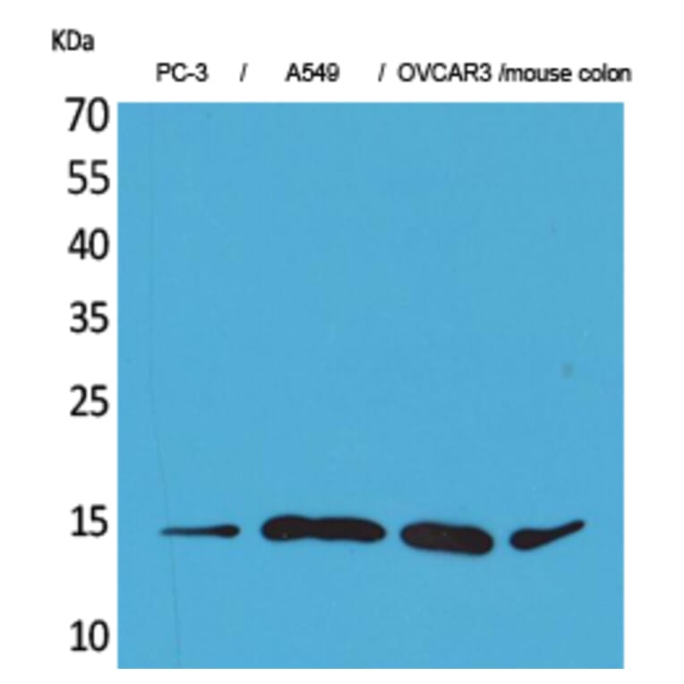 Western Blot - Anti-CCL26 Antibody (C30025) - Antibodies.com