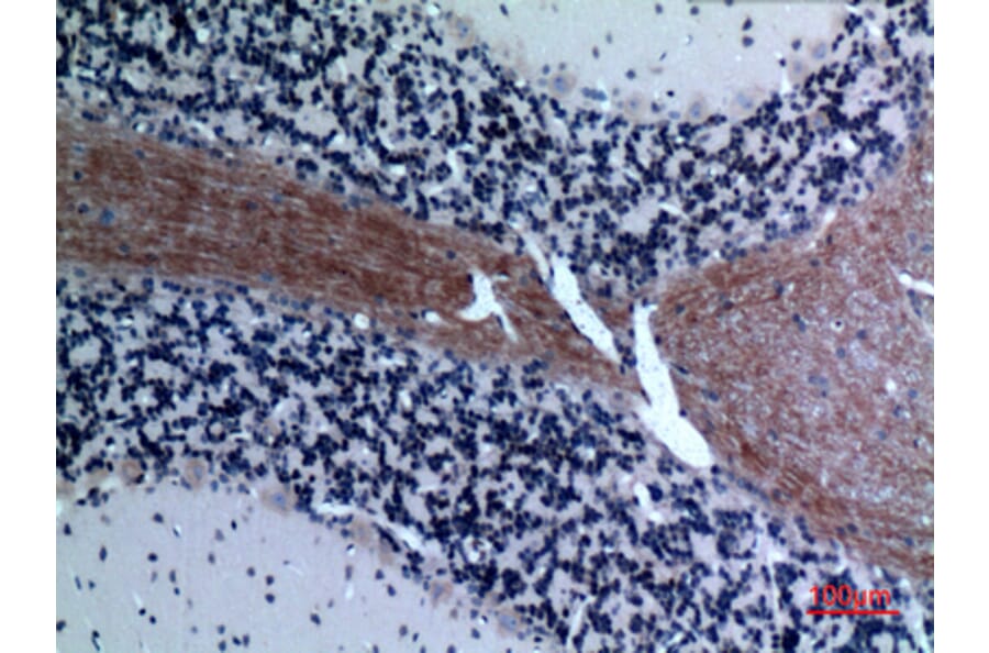 Immunohistochemistry - Anti-CCL26 Antibody (C30025) - Antibodies.com
