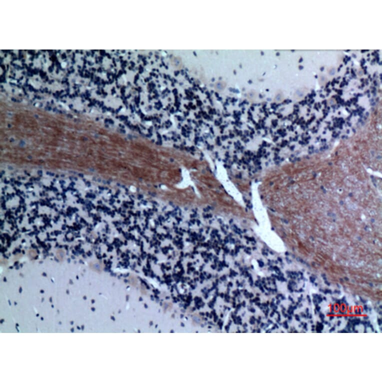 Immunohistochemistry - Anti-CCL26 Antibody (C30025) - Antibodies.com