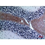 Immunohistochemistry - Anti-CCL26 Antibody (C30025) - Antibodies.com