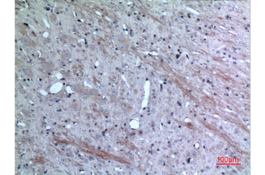 Immunohistochemistry - Anti-CCL26 Antibody (C30025) - Antibodies.com
