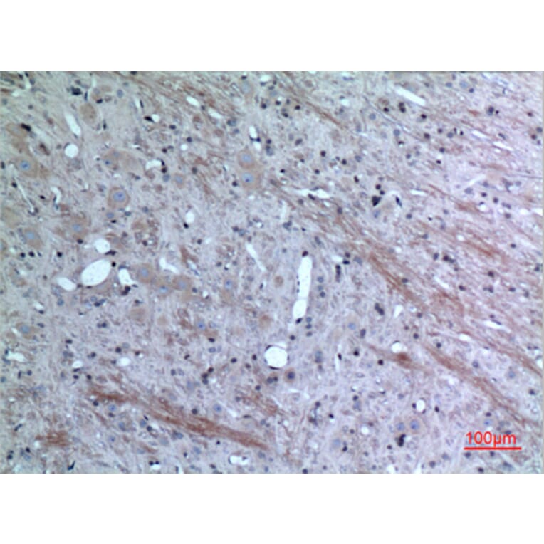 Immunohistochemistry - Anti-CCL26 Antibody (C30025) - Antibodies.com