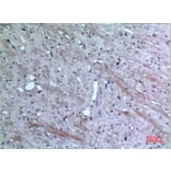 Immunohistochemistry - Anti-CCL26 Antibody (C30025) - Antibodies.com