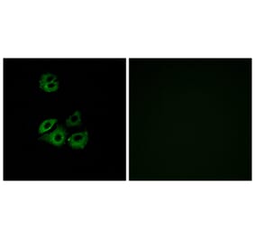 Immunofluorescence - Anti-CCBP2 Antibody (G221) - Antibodies.com