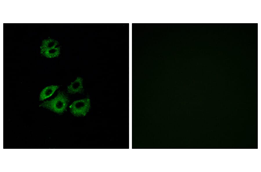 Immunofluorescence - Anti-CCBP2 Antibody (G221) - Antibodies.com