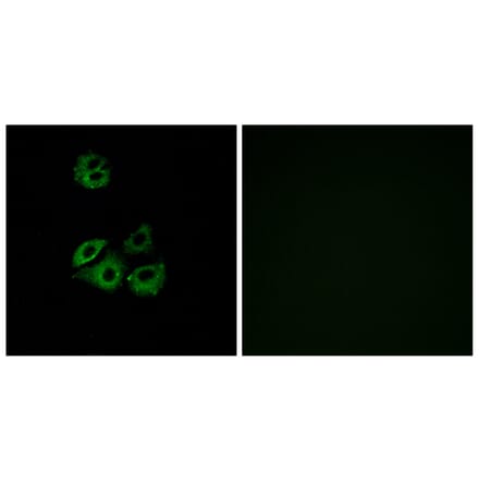 Immunofluorescence - Anti-CCBP2 Antibody (G221) - Antibodies.com