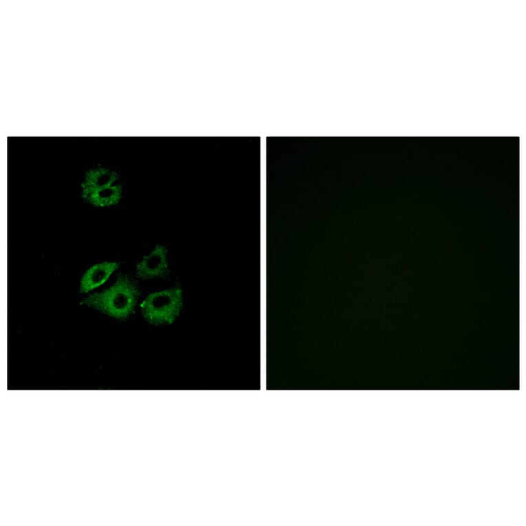 Immunofluorescence - Anti-CCBP2 Antibody (G221) - Antibodies.com