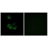 Immunofluorescence - Anti-CCBP2 Antibody (G221) - Antibodies.com