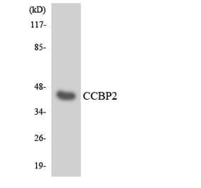 Western Blot - Anti-CCBP2 Antibody (R12-2573) - Antibodies.com