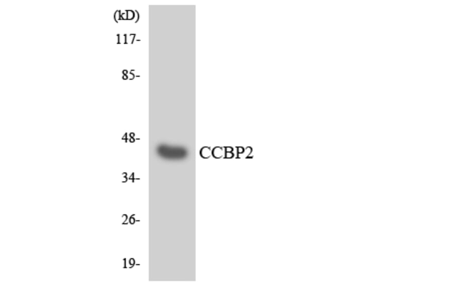 Western Blot - Anti-CCBP2 Antibody (R12-2573) - Antibodies.com