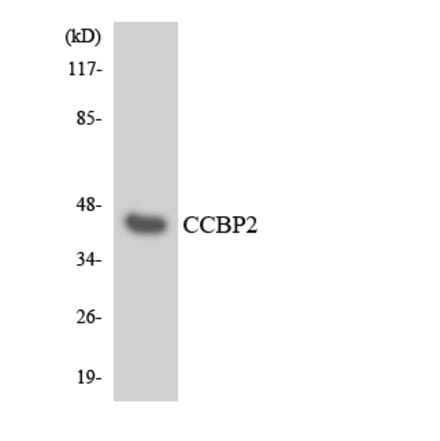 Western Blot - Anti-CCBP2 Antibody (R12-2573) - Antibodies.com