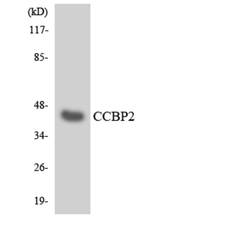 Western Blot - Anti-CCBP2 Antibody (R12-2573) - Antibodies.com
