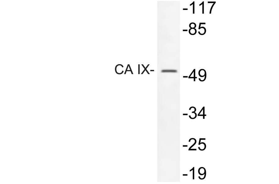 Western Blot - Anti-CA IX Antibody (R12-2047) - Antibodies.com